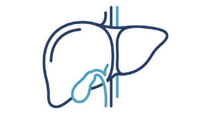 Cirurgia Hepática